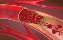 Rendering of the inside of an artery